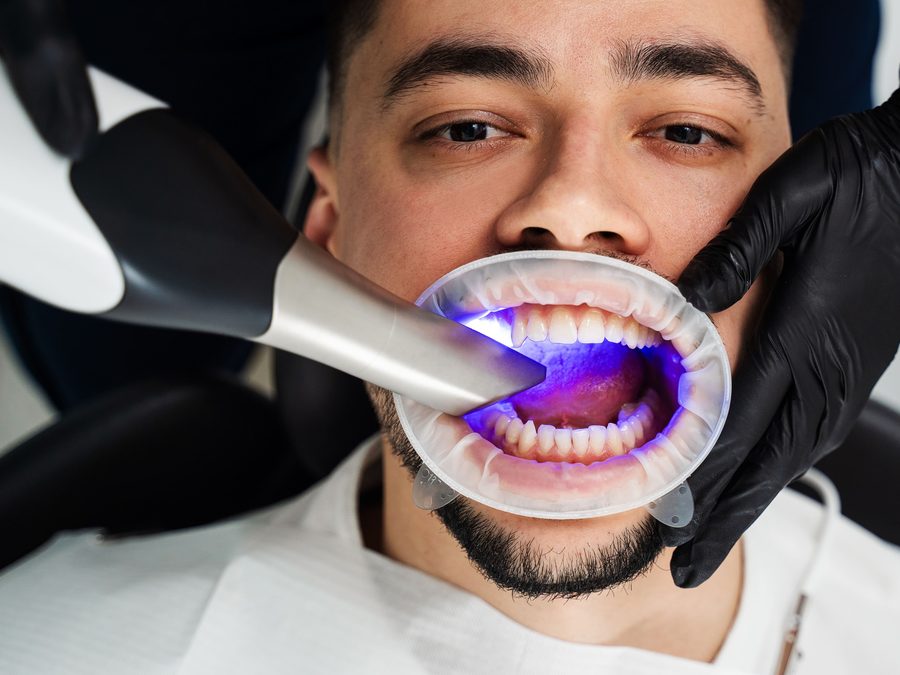 Temsili görsel: 3D Dental Tomografi (KBBT)